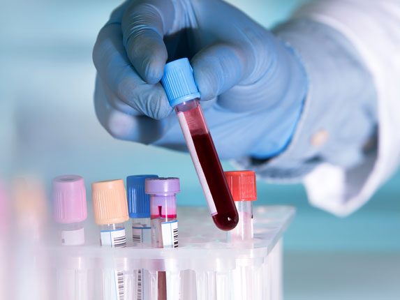 Analisi cliniche - sangue, feci e urine